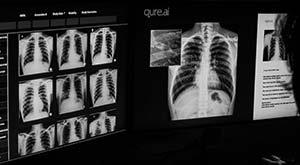 qure-ai-raises--40-million