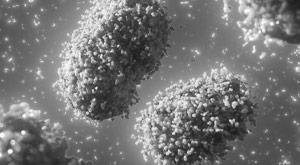 monkeypox-first-deaths-outside-africa-in-brazil-and-spain