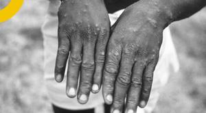 nigeria-bans-bushmeat