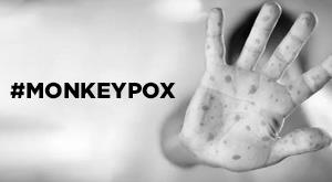 the-risk-of-monkeypox-in-young-children-is-high-claimed-by-researchers