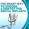 The Smart Way to Choose a Dentist for Dental Implants