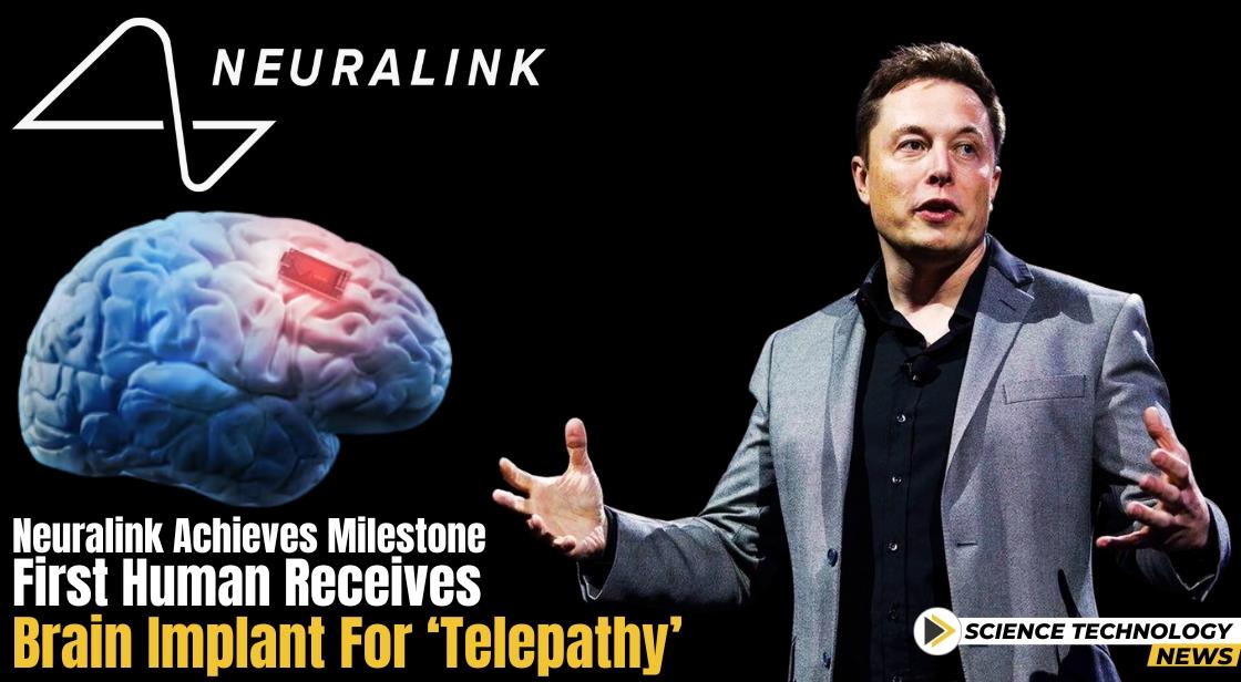Neuralink Achieves Milestone: First Human Receives Brain Implant for ‘Telepathy’