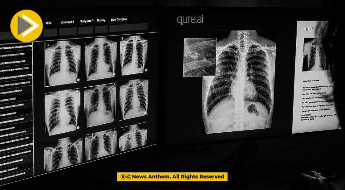 Qure.ai Raises $40 million