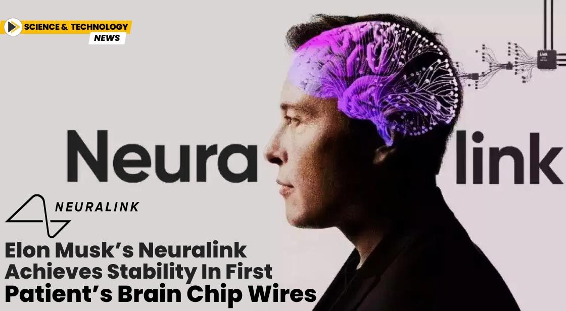Elon Musk’s Neuralink Achieves Stability in First Patient’s Brain Chip Wires