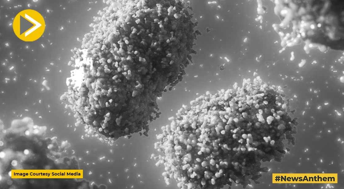 Monkeypox: First deaths outside Africa in Brazil and Spain
