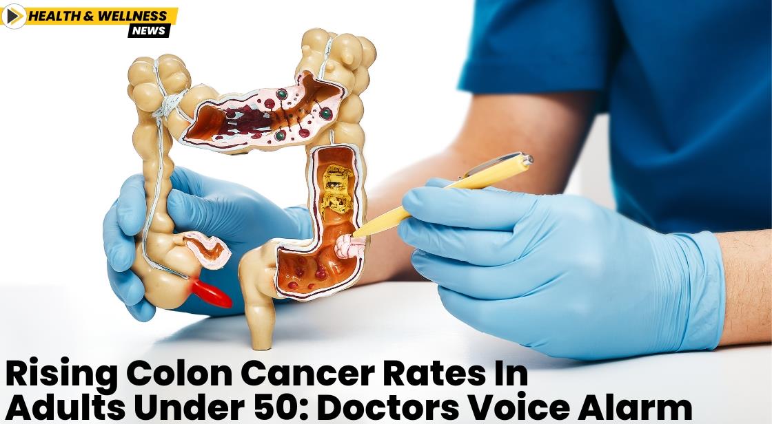 Rising Colon Cancer Rates in Adults Under 50: Doctors Voice Alarm