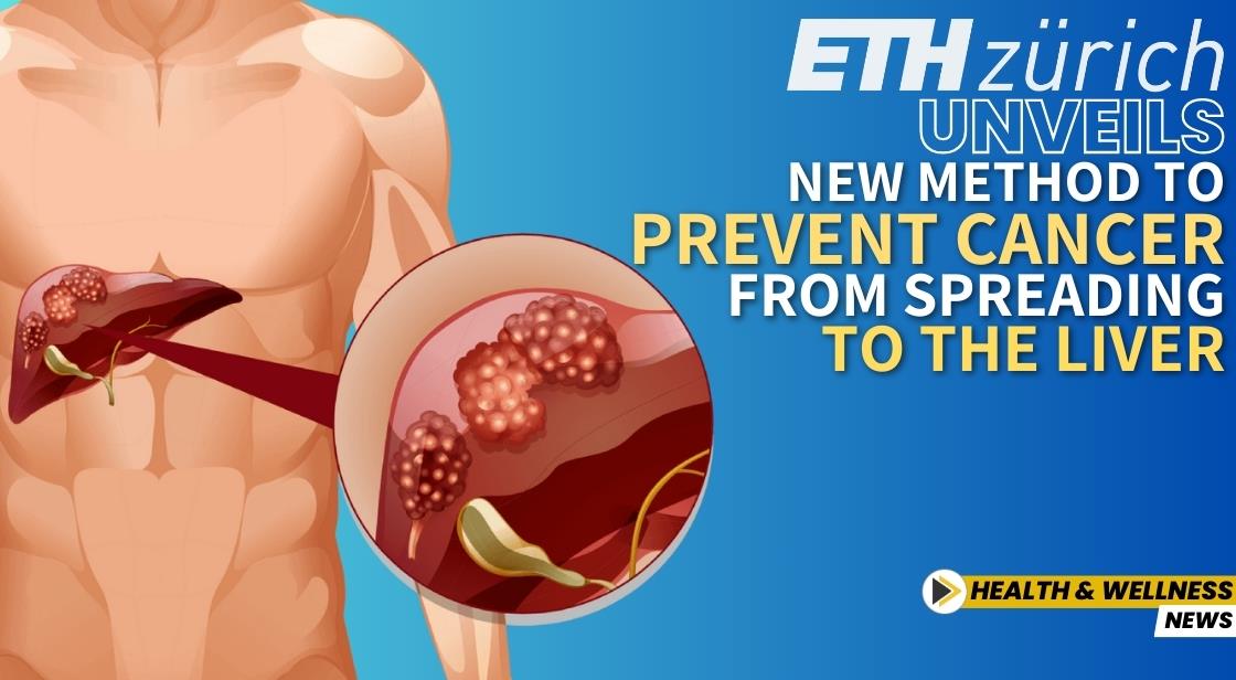 ETH Zurich Unveils New Method to Prevent Cancer from Spreading to the Liver